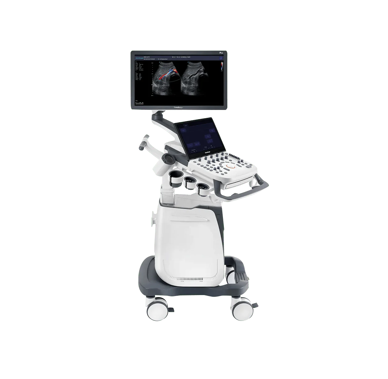 Ecógrafo doppler color con carro de traslado Sonoscape P25 con 1 transductor standard a elección - Imagen 3